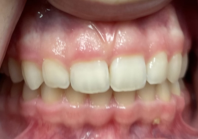 Before and After image