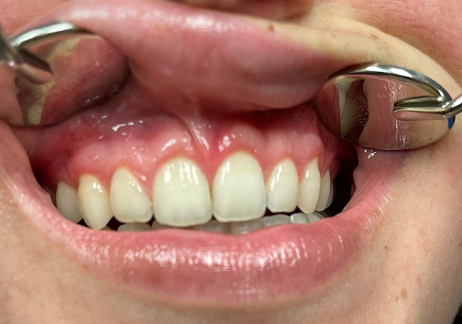 Before and After image